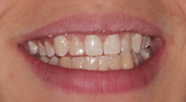 After - Nailsea Dental Practice