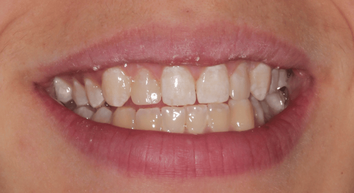 After - Nailsea Dental Practice