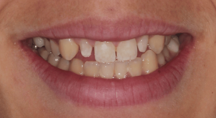 Before - Nailsea Dental Practice