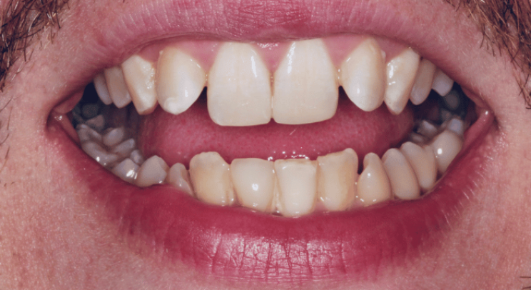 After - Nailsea Dental Practice