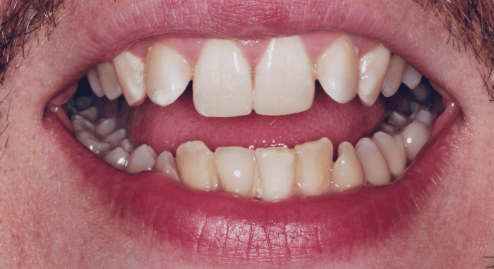 After - Nailsea Dental Practice