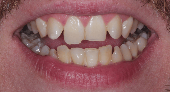 Before - Nailsea Dental Practice