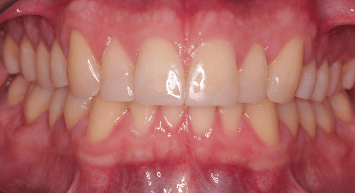 After - Nailsea Dental Practice