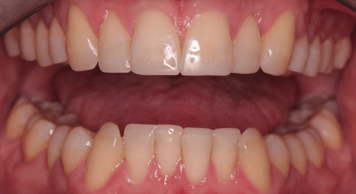 After - Nailsea Dental Practice