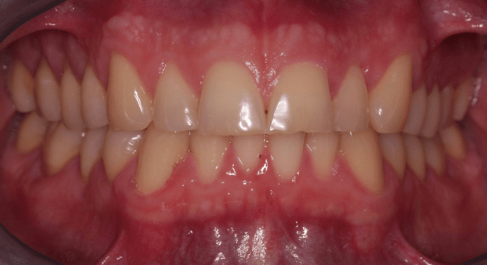 Before - Nailsea Dental Practice