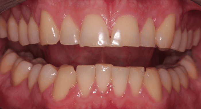 Before - Nailsea Dental Practice