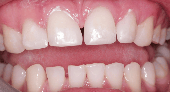 After - Nailsea Dental Practice