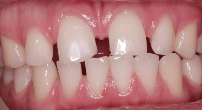 Before - Nailsea Dental Practice