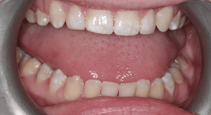 After - Nailsea Dental Practice