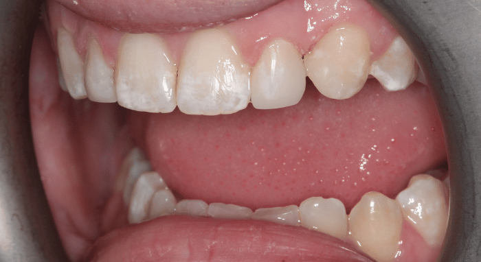 After - Nailsea Dental Practice