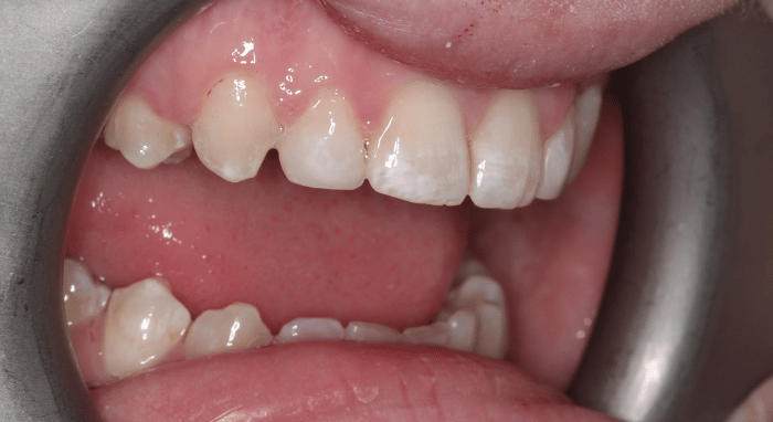 After - Nailsea Dental Practice