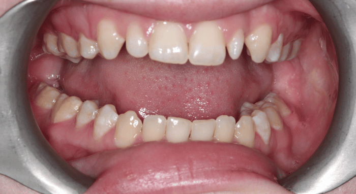 Before - Nailsea Dental Practice