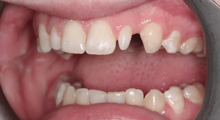 Before - Nailsea Dental Practice