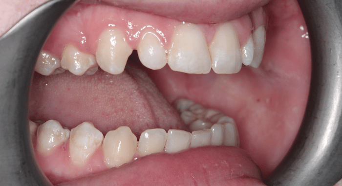 Before - Nailsea Dental Practice