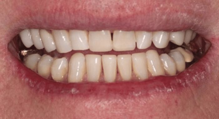 After - Nailsea Dental Practice