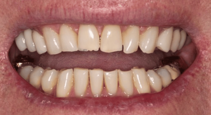 Before - Nailsea Dental Practice