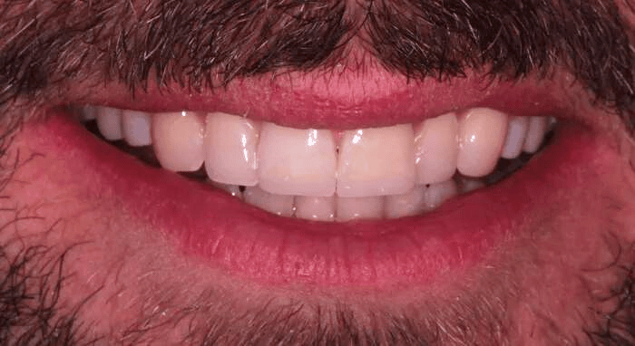 After - Nailsea Dental Practice