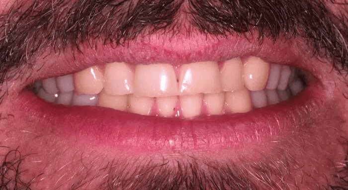 Before - Nailsea Dental Practice