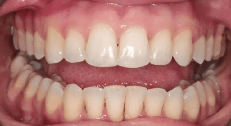 After - Nailsea Dental Practice