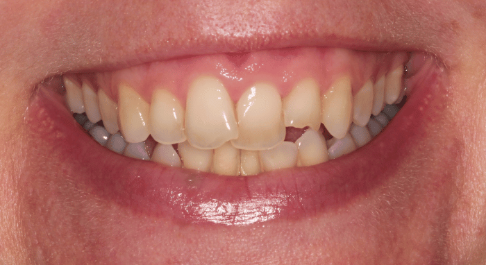 Before - Nailsea Dental Practice