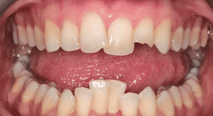 Before - Nailsea Dental Practice