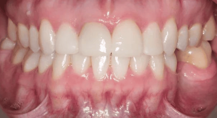 After - Nailsea Dental Practice