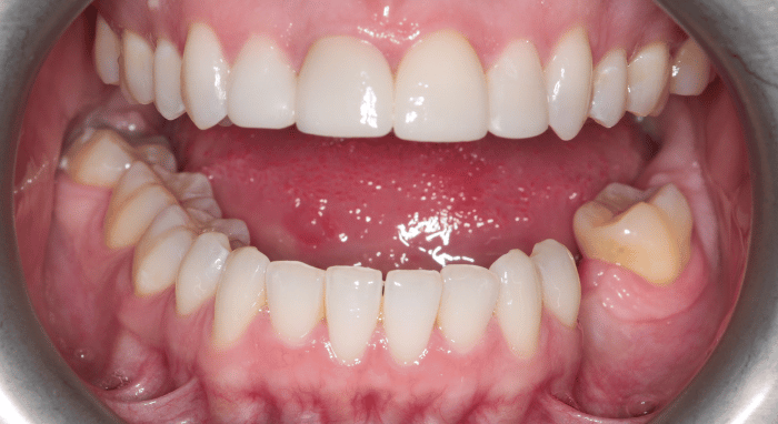 After - Nailsea Dental Practice