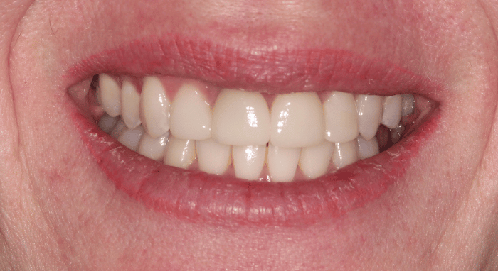 After - Nailsea Dental Practice