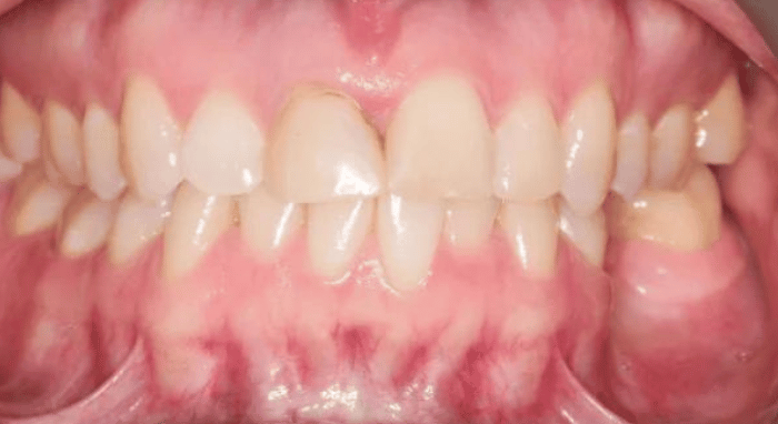 Before - Nailsea Dental Practice