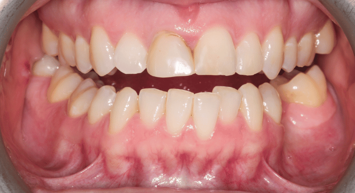 Before - Nailsea Dental Practice