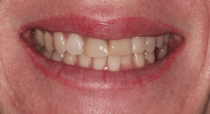 Before - Nailsea Dental Practice