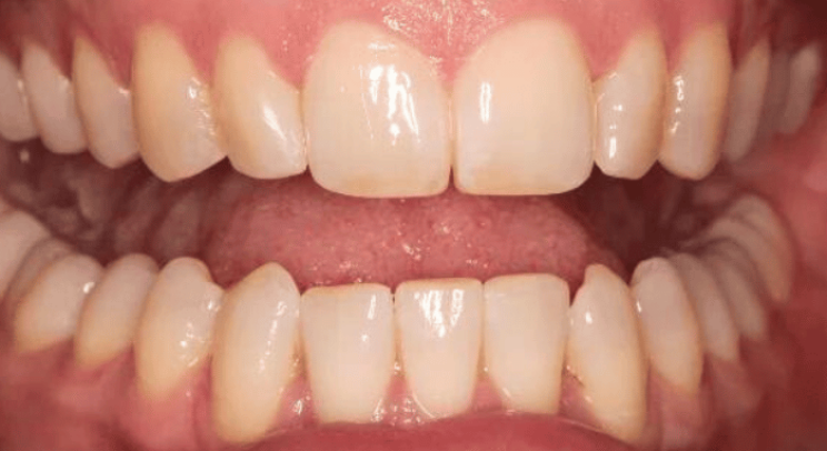 After - Nailsea Dental Practice