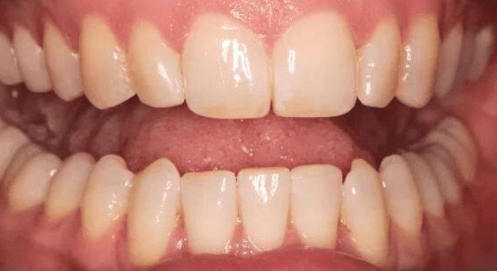 After - Nailsea Dental Practice