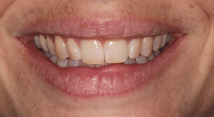 After - Nailsea Dental Practice