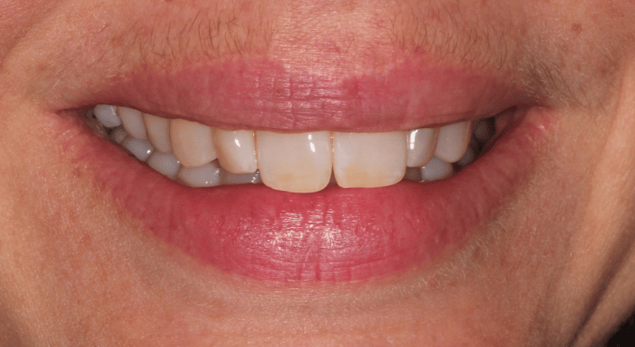 Before - Nailsea Dental Practice