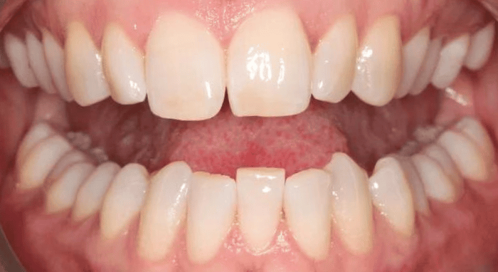 Before - Nailsea Dental Practice