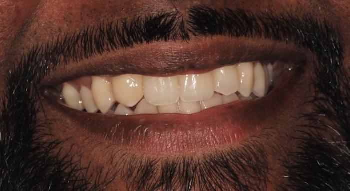 After - Nailsea Dental Practice