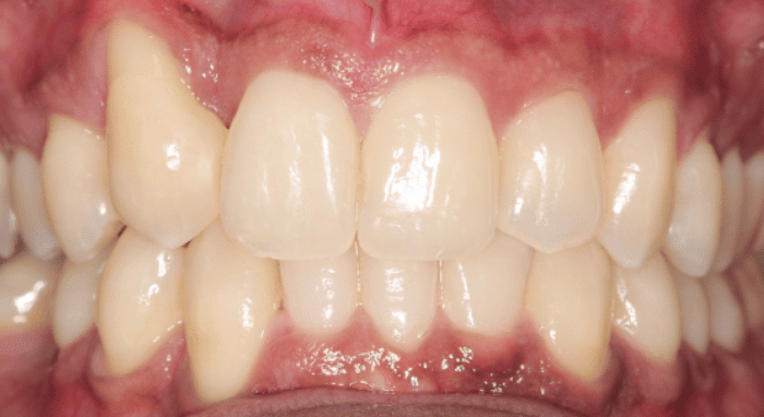 After - Nailsea Dental Practice