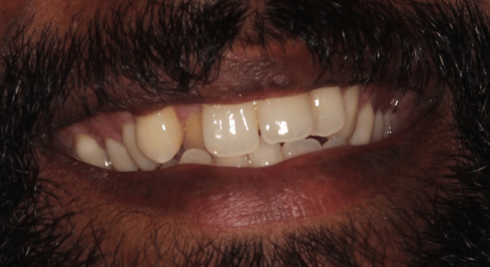 Before - Nailsea Dental Practice