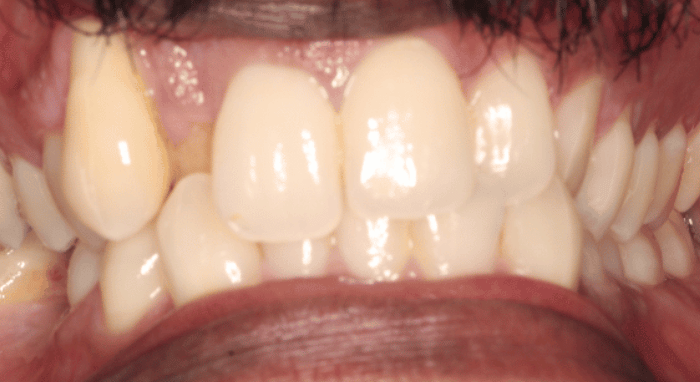 Before - Nailsea Dental Practice