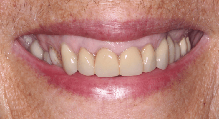 After - Nailsea Dental Practice