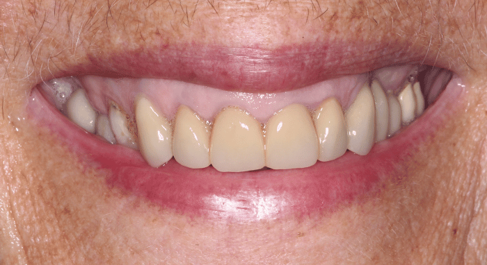 After - Nailsea Dental Practice