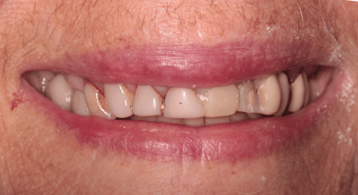 Before - Nailsea Dental Practice