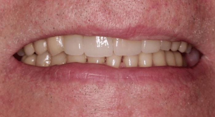 After - Nailsea Dental Practice