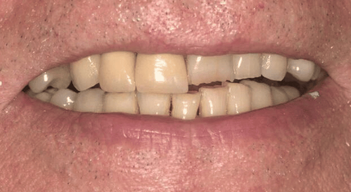 Before - Nailsea Dental Practice