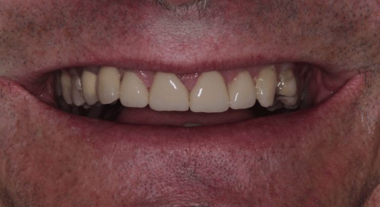 After - Nailsea Dental Practice