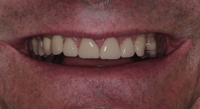 After - Nailsea Dental Practice