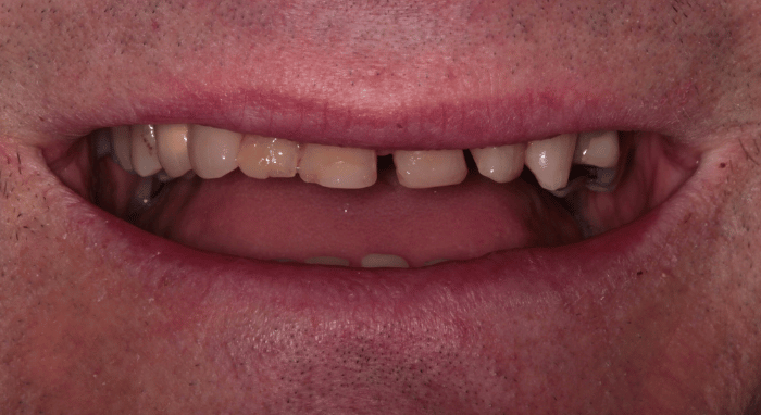 Before - Nailsea Dental Practice