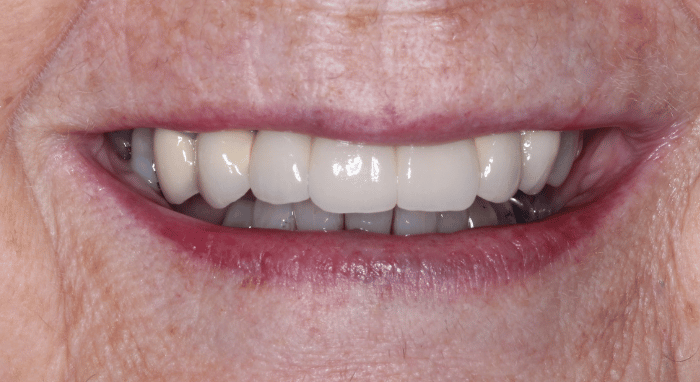 After - Nailsea Dental Practice