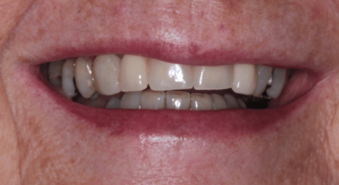 Before - Nailsea Dental Practice